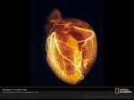 heart-angiogram-sd3453-sw
